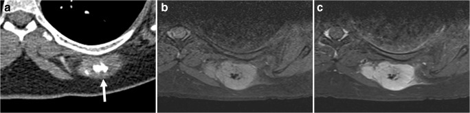 Fig. 17