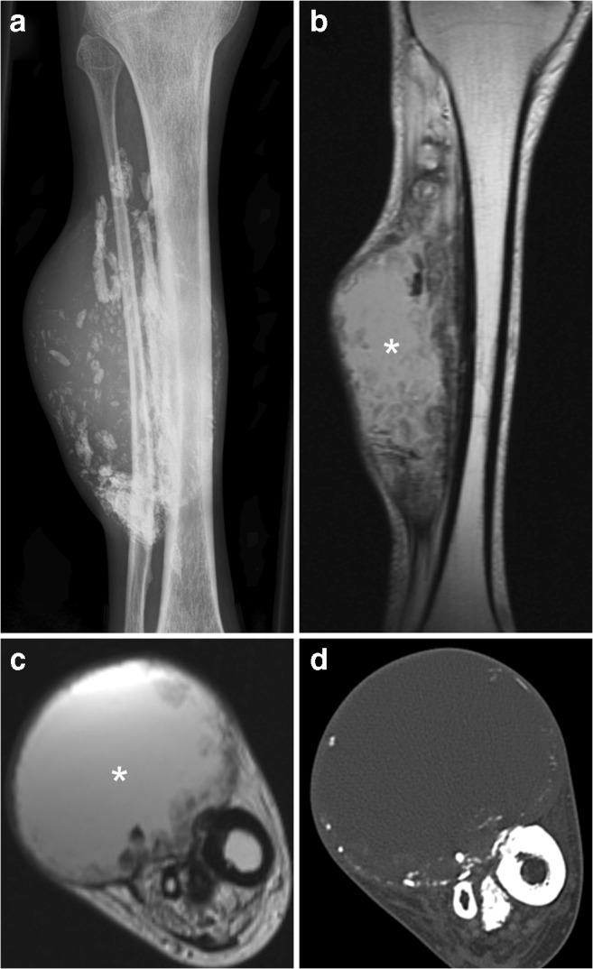 Fig. 15
