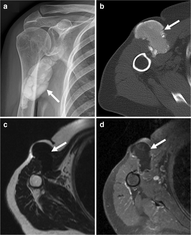 Fig. 12