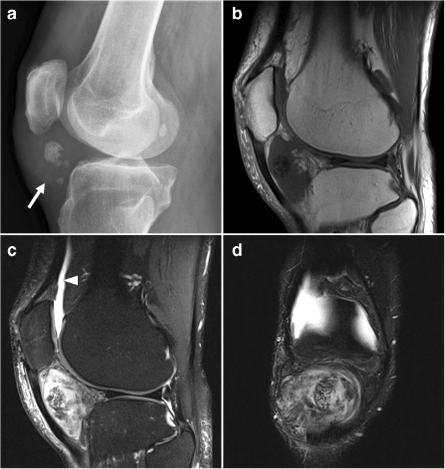 Fig. 11