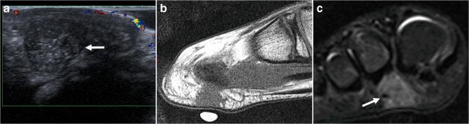 Fig. 14