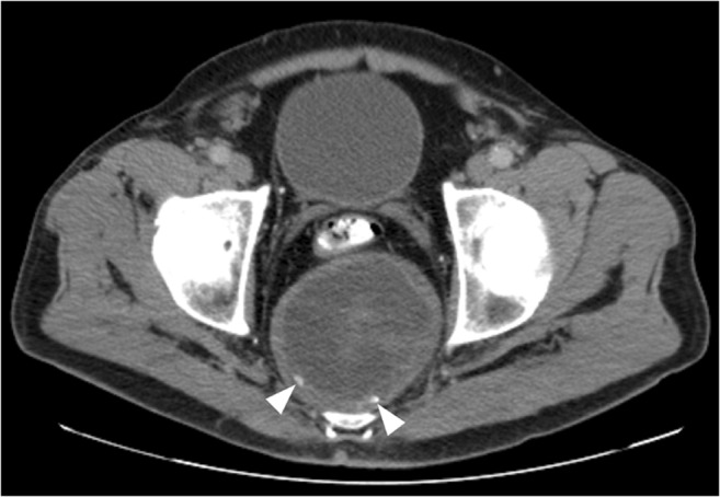 Fig. 16.