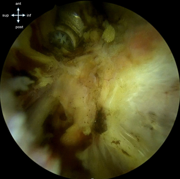Fig. 4