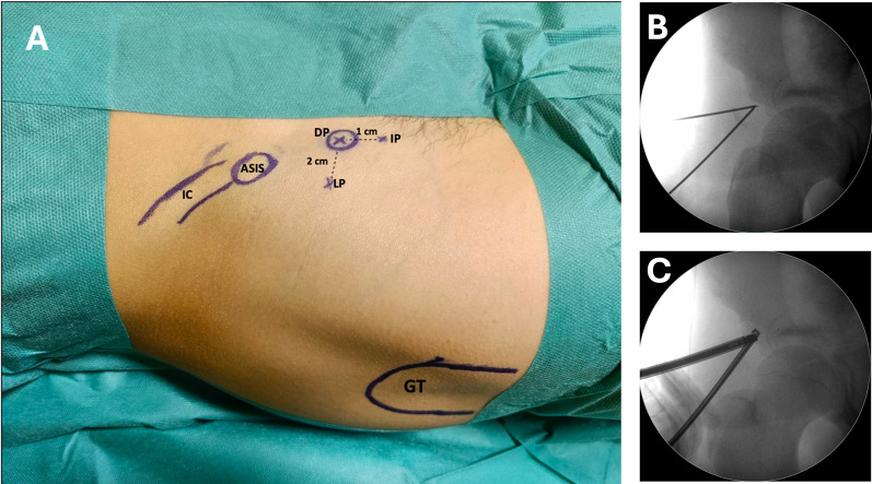 Fig. 2