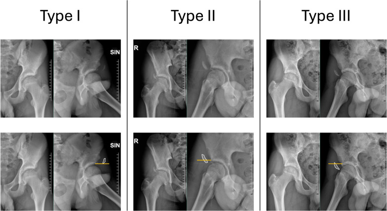 Fig. 1