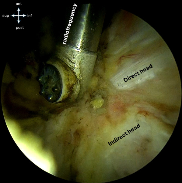 Fig. 3