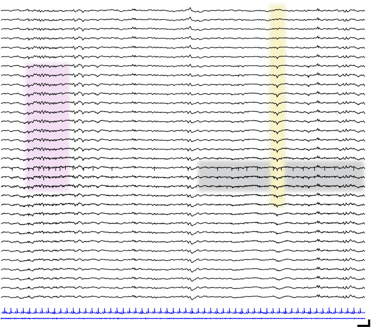 Figure 1—figure supplement 4.