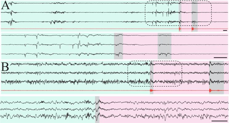 Figure 1—figure supplement 5.