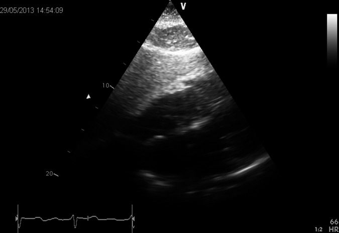 Figure 3