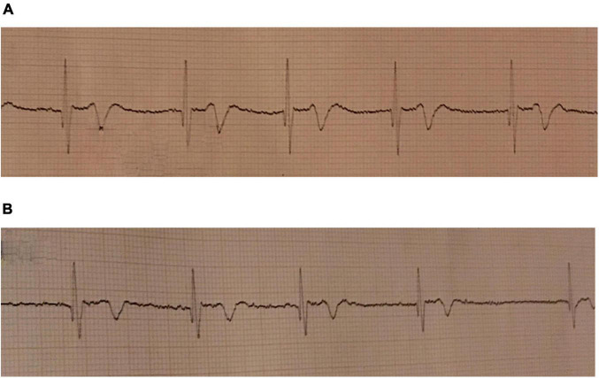 FIGURE 3