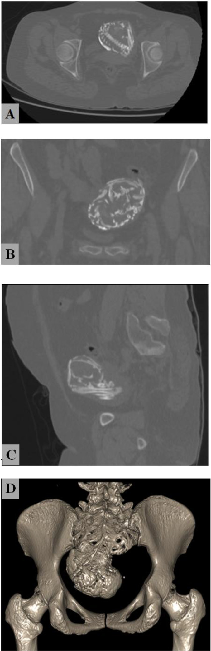 Fig 2