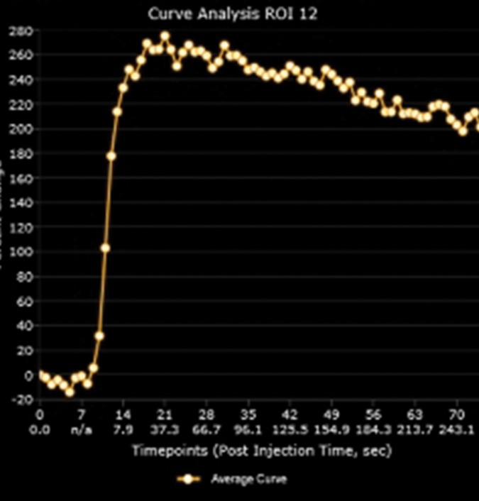 Figure 1d: