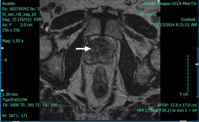 Figure 2a: