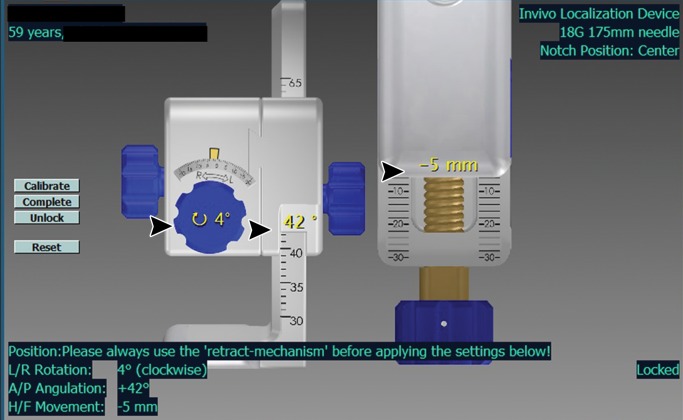 Figure 2b: