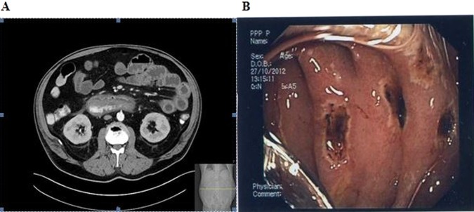 Figure 1