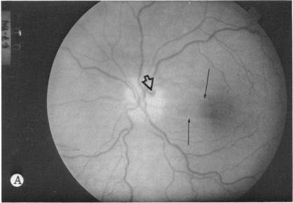 FIGURE 13 A