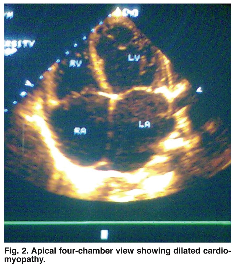 Fig. 2.