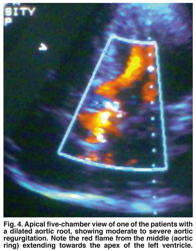 Fig. 4.