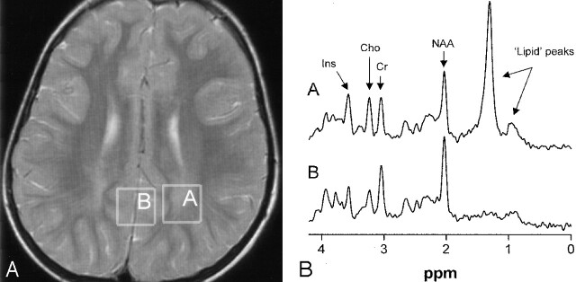 Fig 5.