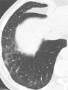 Figure 2b:
