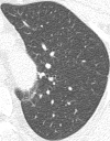 Figure 1b: