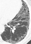 Figure 3b: