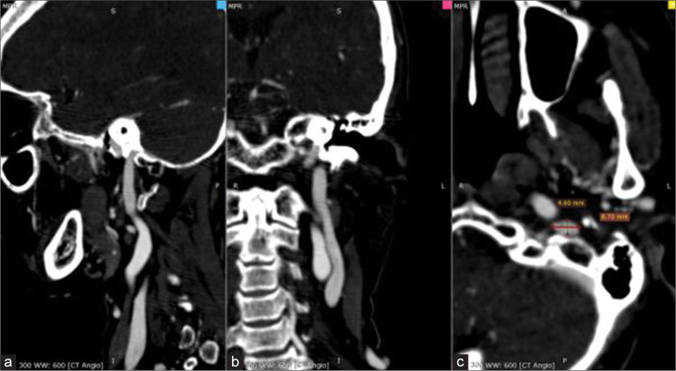 Figure 2: