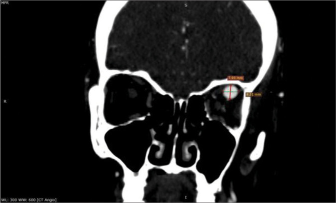 Figure 3: