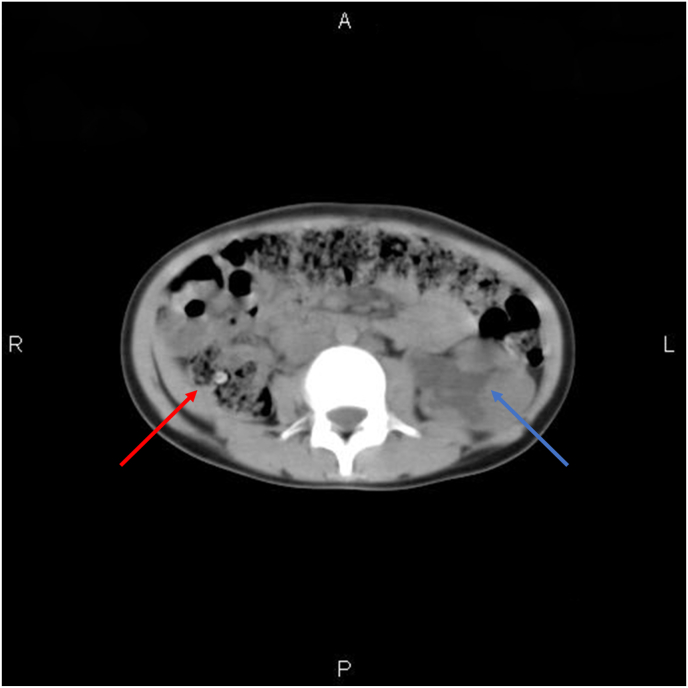 Fig. 1