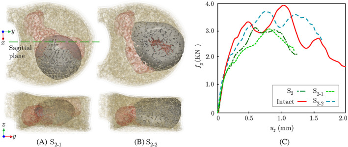 FIGURE 11