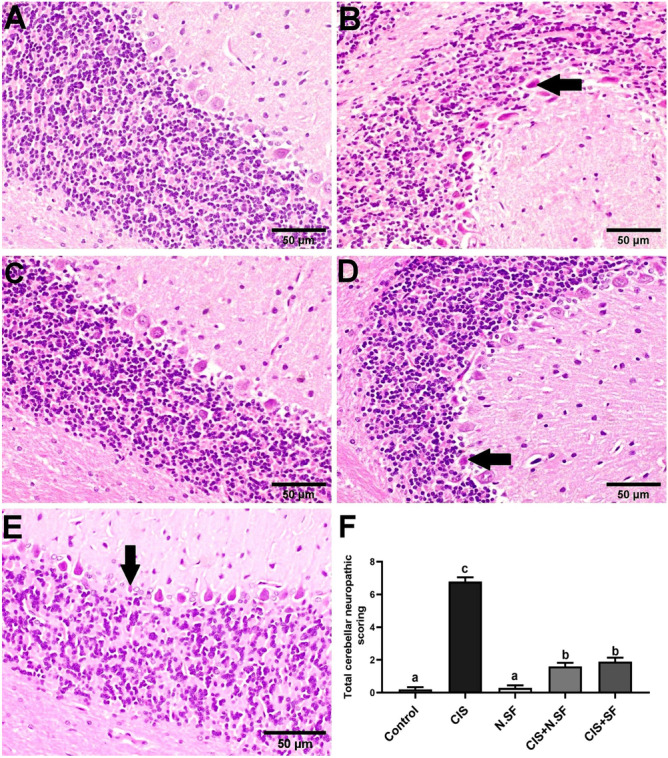 Fig. 12