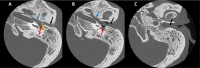 Fig 5