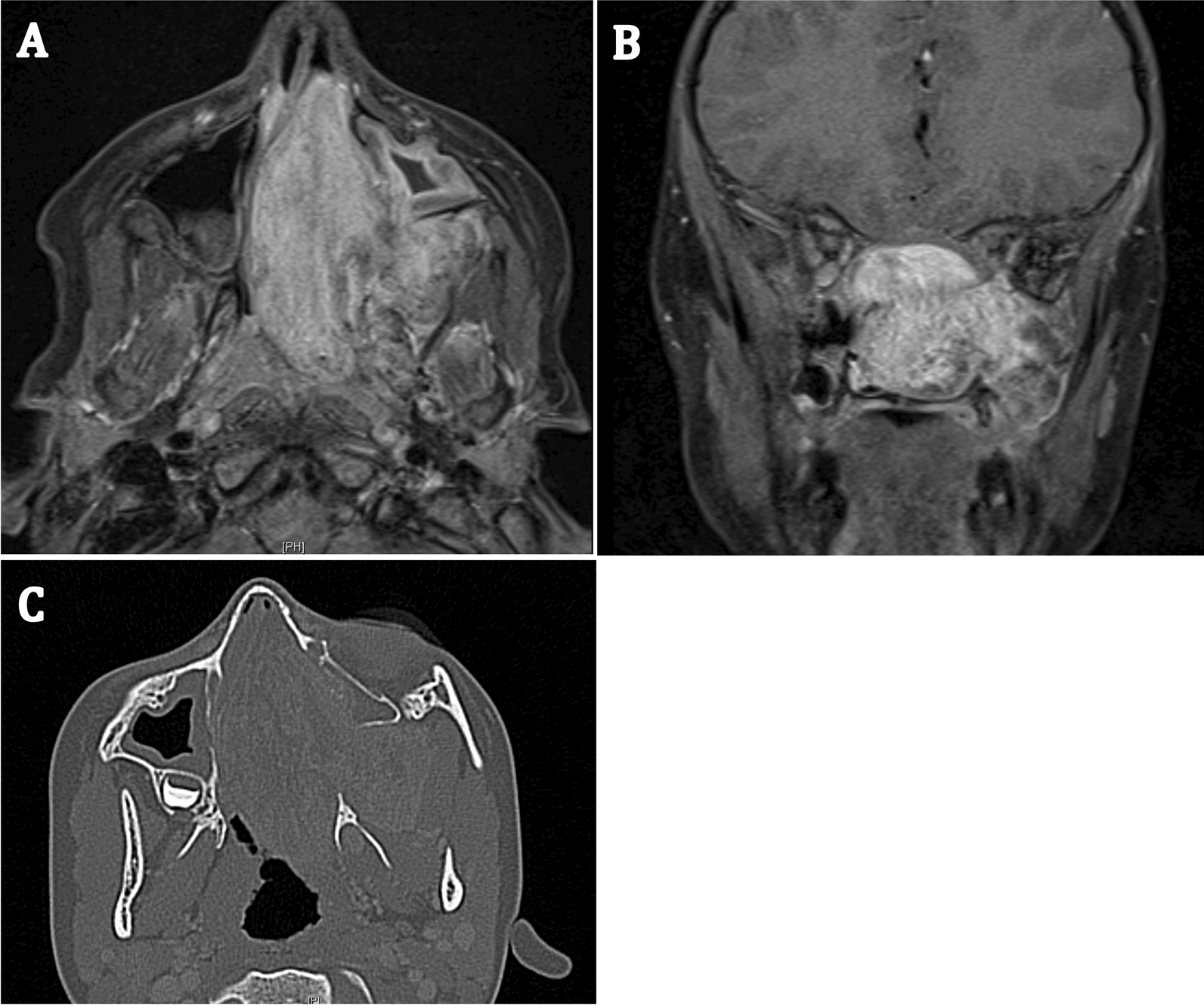 Fig. 2