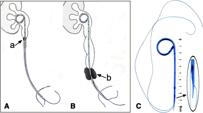 Fig. 1