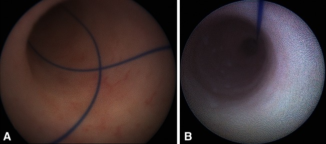 Fig. 3