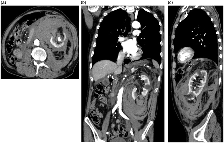 Fig. 2.