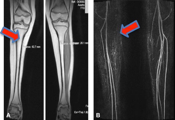 Fig. 4A–B