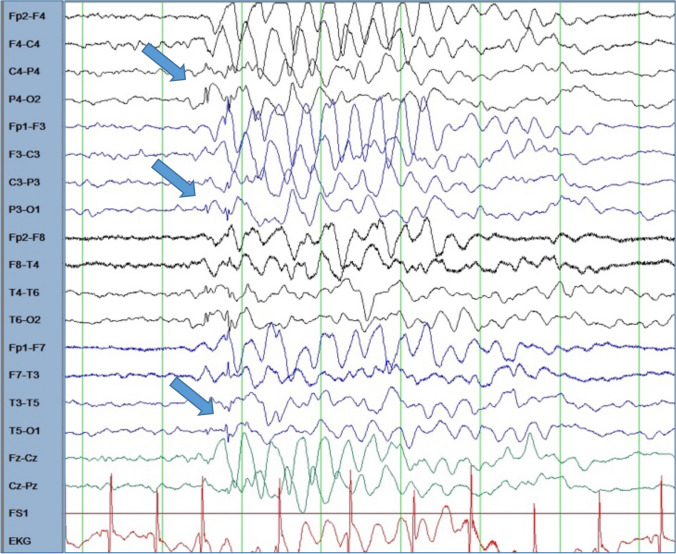 Fig. 3