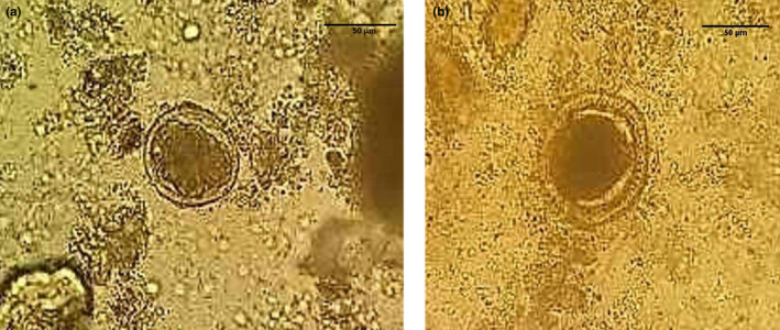 FIGURE 1 a & b