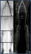 Fig 2