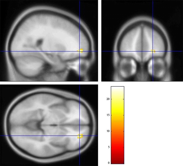 Fig. 2