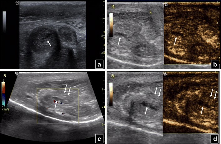 Fig. 12