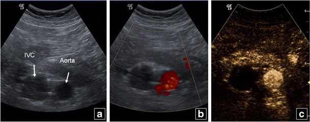 Fig. 13