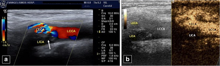 Fig. 14