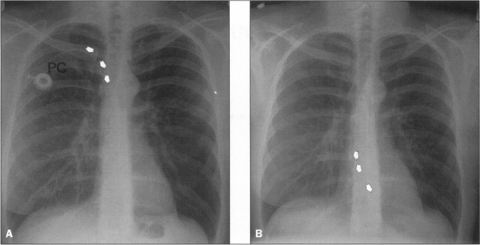 Figure 1A and B