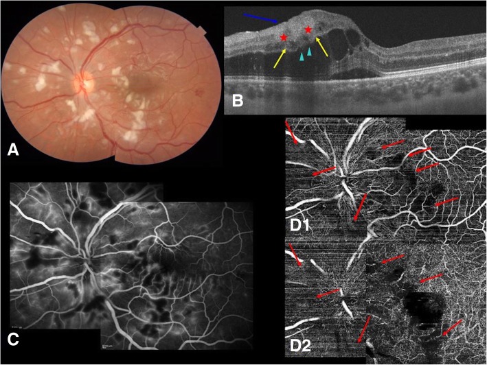 Fig. 1