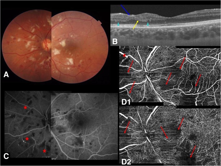 Fig. 2