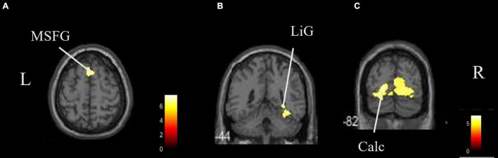 FIGURE 4