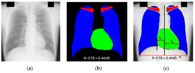 Figure 12