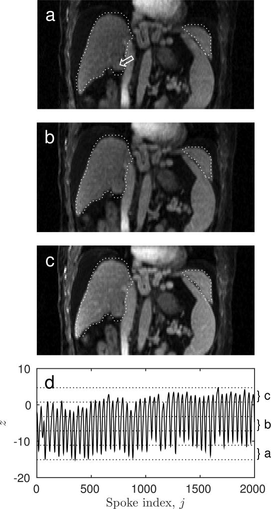 FIG. 8